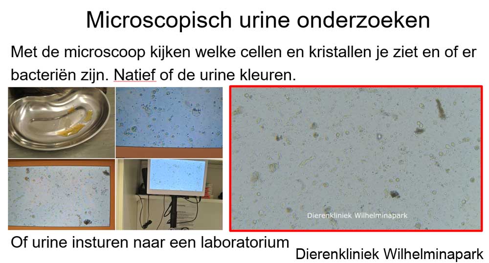 Urine bekijken met een microscoop